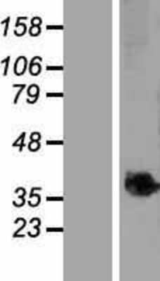 Western Blot: TMEM268 Overexpression Lysate [NBP2-05250]