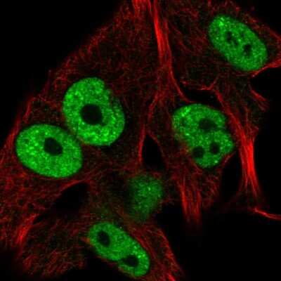 Immunocytochemistry/ Immunofluorescence: CCDC171 Antibody [NBP1-90784]