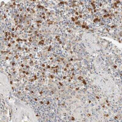 Immunohistochemistry: CCDC171 Antibody [NBP1-90784]