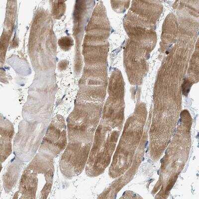 Immunohistochemistry: CCDC171 Antibody [NBP1-90785]