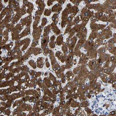 Immunohistochemistry: CCDC171 Antibody [NBP1-90786]