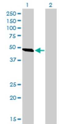 Western Blot: Adenylate Kinase 8 Antibody (3B8) [H00158067-M01]