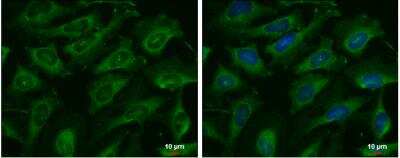 Immunocytochemistry/ Immunofluorescence: Adenylate Kinase 8 Antibody [NBP1-32319]