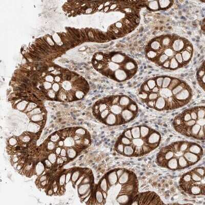 Immunohistochemistry-Paraffin: Adenylate Kinase 8 Antibody [NBP1-88242]