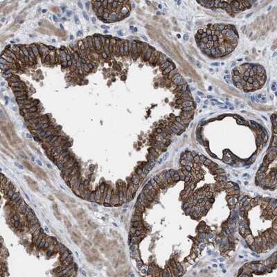 Immunohistochemistry-Paraffin: Adenylate Kinase 8 Antibody [NBP1-88243]