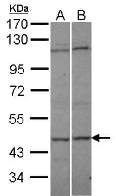 Western Blot: Adenylate Kinase 8 Antibody [NBP1-32319]