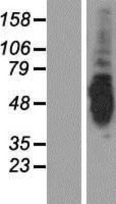 Western Blot: Adenylate Kinase 8 Overexpression Lysate [NBP2-05338]