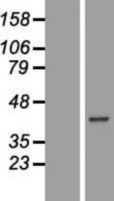 Western Blot: Carbonic Anhydrase X/CA10 Overexpression Lysate [NBL1-08610]