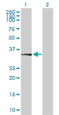 Western Blot: CA11 Antibody [H00000770-B02P]