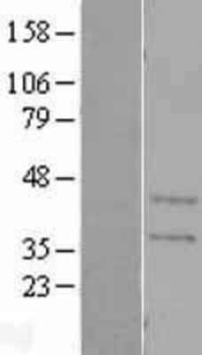 Western Blot: CA11 Overexpression Lysate [NBL1-08611]