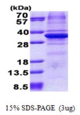 SDS-PAGE: Recombinant Human CA11 His Protein [NBP2-22731]