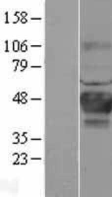 Western Blot: Carbonic Anhydrase XII/CA12 Overexpression Lysate [NBL1-08612]