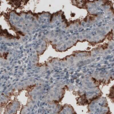 Immunohistochemistry-Paraffin: CA125/MUC16 Antibody (CL2783) [NBP2-59024]