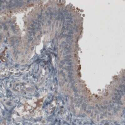 Immunohistochemistry-Paraffin: CA125/MUC16 Antibody (CL2783) [NBP2-59024]
