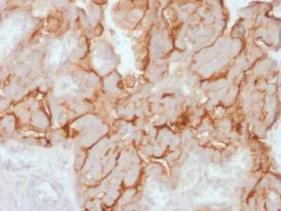 Immunohistochemistry-Paraffin: CA125/MUC16 Antibody (OCA125/2349R) - Azide and BSA Free [NBP3-08371]