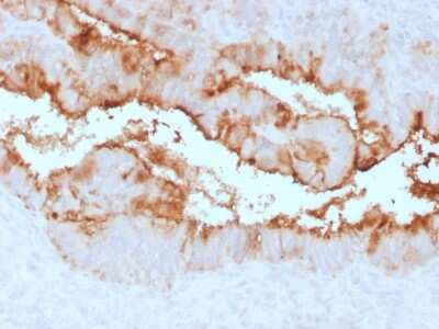 Immunohistochemistry-Paraffin: CA125/MUC16 Antibody (OCA125/2349R) - Azide and BSA Free [NBP3-08371]