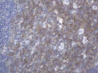 Immunohistochemistry: CA125/MUC16 Antibody (OTI2C4) - Azide and BSA Free [NBP2-72336]