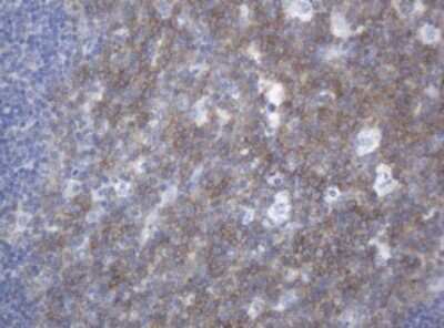 Immunohistochemistry: CA125/MUC16 Antibody (OTI2C4) [NBP2-46051]