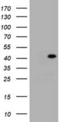 Western Blot: CA125/MUC16 Antibody (OTI2C4) [NBP2-46051]