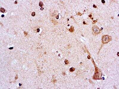 Immunohistochemistry-Paraffin: CA15-3 Antibody (DBMM1) [NBP2-26672]