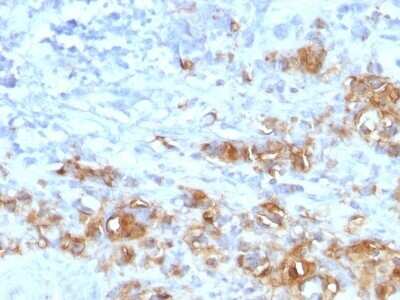 Immunohistochemistry-Paraffin: CA19-9/Sialyl Lewis A Antibody (CA19.9/1390R) - Azide and BSA Free [NBP2-54585]