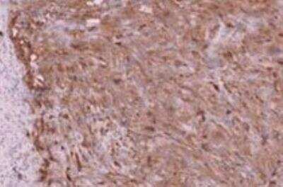 Immunohistochemistry-Paraffin: CA19-9/Sialyl Lewis A Antibody (SPM588) [NBP2-45199]