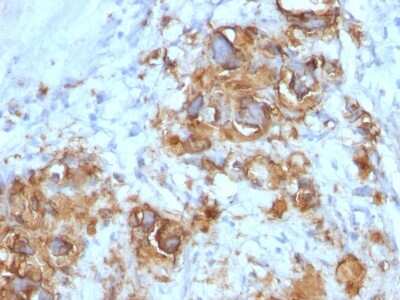 Immunohistochemistry-Paraffin: CA19-9/Sialyl Lewis A Antibody (121SLE) - Azide and BSA Free [NBP2-54349]