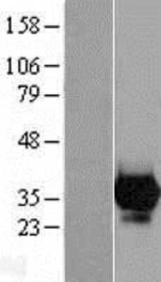 Western Blot: Carbonic Anhydrase VII/CA7 Overexpression Lysate [NBL1-08618]