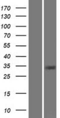 Western Blot: Carbonic Anhydrase VIII/CA8 Overexpression Lysate [NBP2-07919]