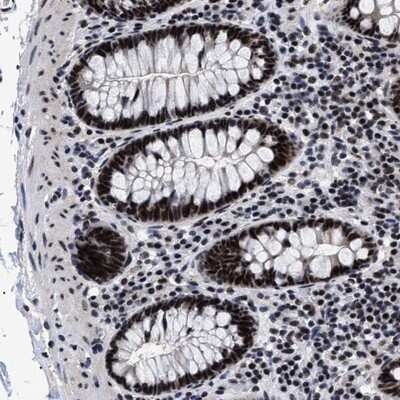 Immunohistochemistry-Paraffin: CAAP1 Antibody [NBP1-94018]