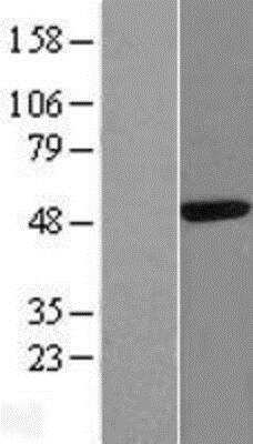 Western Blot: CAAP1 Overexpression Lysate [NBP2-06251]