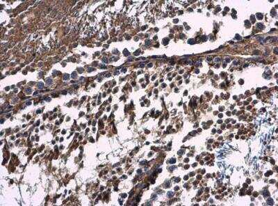 Immunohistochemistry-Paraffin: CAB39 Antibody [NBP2-15658]