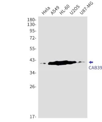 Western Blot: CAB39 Antibody (S03-4G7) [NBP3-19841]