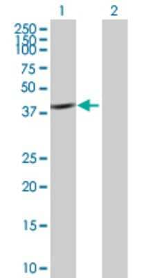 Western Blot: CAB39 Antibody [H00051719-B01P]