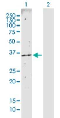 Western Blot: CAB39 Antibody [H00051719-D01P]