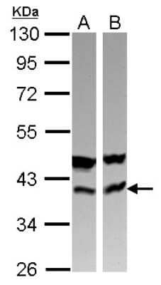 Western Blot: CAB39 Antibody [NBP2-15658]