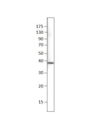 Western Blot: CAB39 Antibody [NBP3-12457]