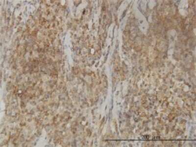 Immunohistochemistry-Paraffin: CAB39L Antibody (3B11-1A4) [H00081617-M01]