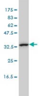 Western Blot: CAB39L Antibody (3B11-1A4) [H00081617-M01]