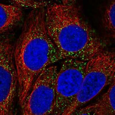 Immunocytochemistry/ Immunofluorescence: CAB39L Antibody [NBP2-32039]