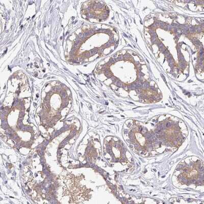 Immunohistochemistry-Paraffin: CAB39L Antibody [NBP2-32039]