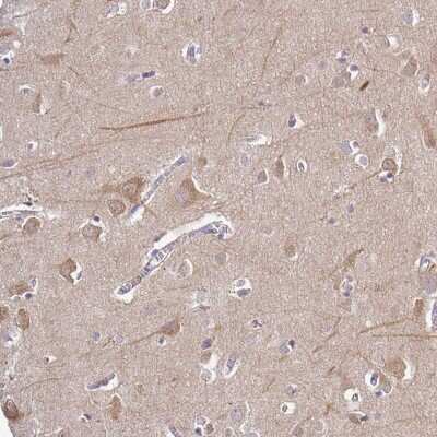 Immunohistochemistry-Paraffin: CAB39L Antibody [NBP2-32039]