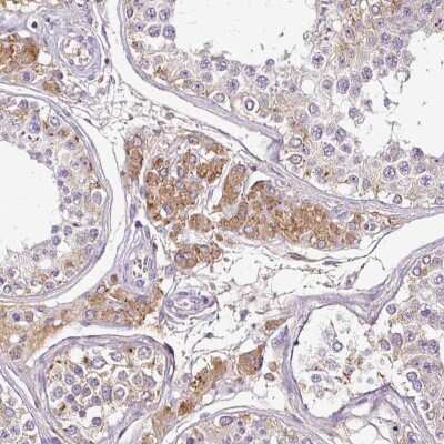 Immunohistochemistry-Paraffin: CAB39L Antibody [NBP2-32039]