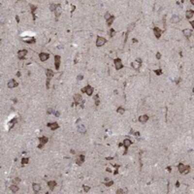 Immunohistochemistry-Paraffin: CAB39L Antibody [NBP3-17812]