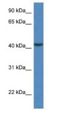 Western Blot: CAB39L Antibody [NBP1-74079]