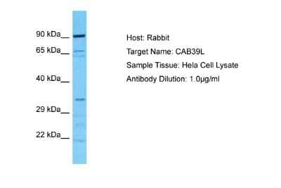 Western Blot: CAB39L Antibody [NBP2-87106]