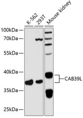 Western Blot: CAB39L AntibodyAzide and BSA Free [NBP2-92451]