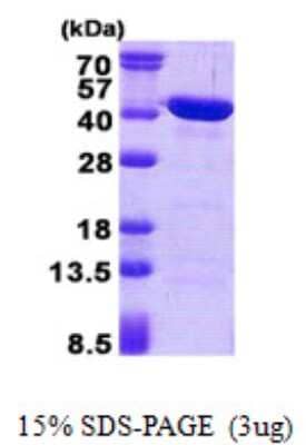 SDS-PAGE: Recombinant Human CAB39L His Protein [NBP2-22724]