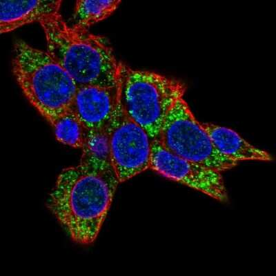 Immunocytochemistry/ Immunofluorescence: CABC1 Antibody [NBP2-56006]