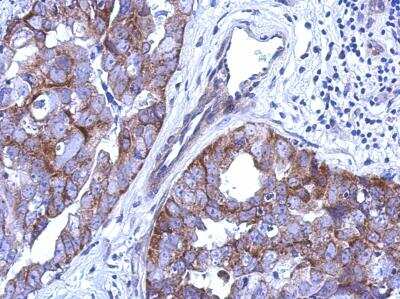 Immunohistochemistry-Paraffin: CABC1 Antibody [NBP2-15659]